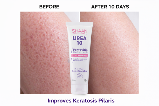 Shaan Urea 10% Body Moisturizer 200 Gm - Image 2 | Deoora