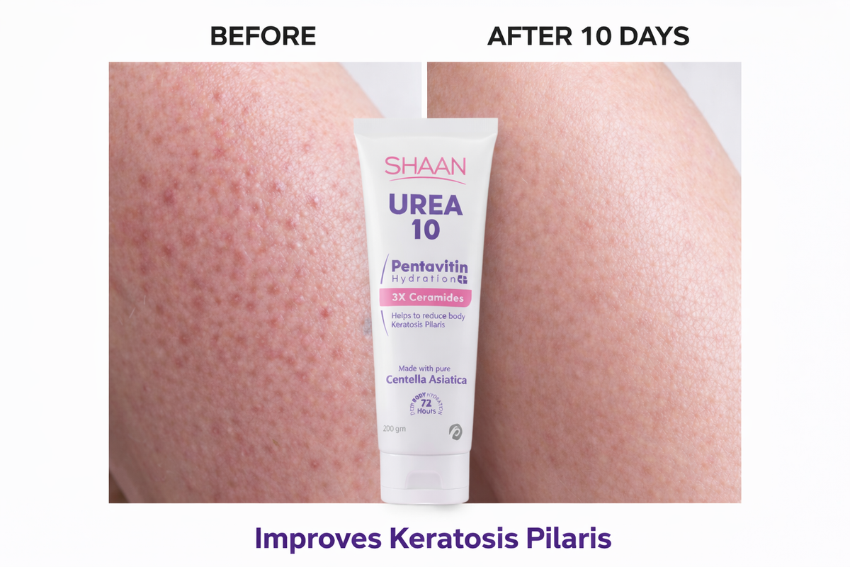 Shaan Urea 10% Body Moisturizer 200 Gm - Image 2 | Deoora