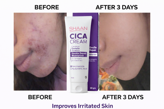 Shaan CICA cream 60 ml - Image 2 | Deoora