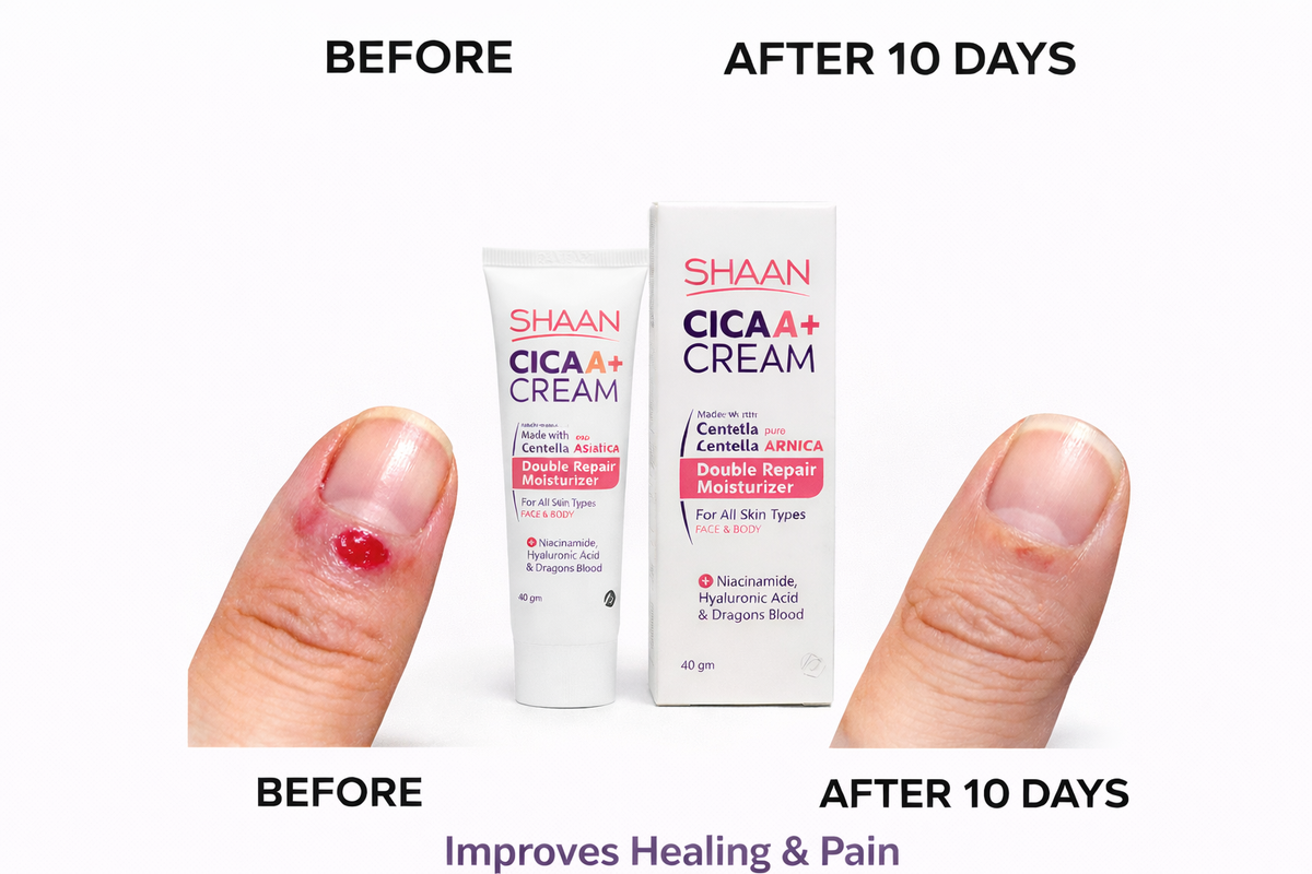 Shaan CICA ARNICA+ cream 40gm - Image 2 | Deoora