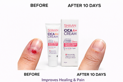 Shaan CICA ARNICA+ cream 40gm - Image 2 | Deoora