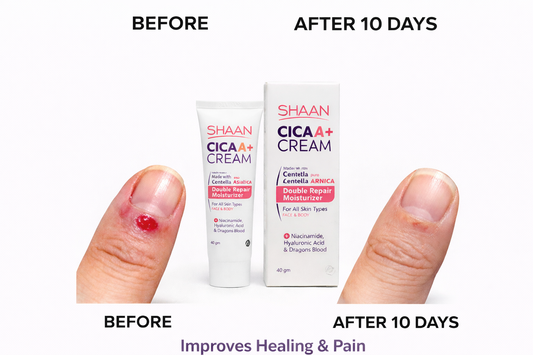 Shaan CICA ARNICA+ cream 40gm - Image 2 | Deoora