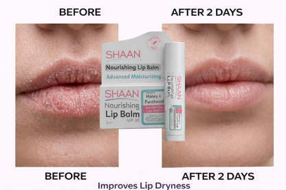 Shaan Lip Balm SPF 30 5 gm - Image 2 | Deoora