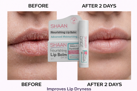 Shaan Lip Balm SPF 30 5 gm - Image 2 | Deoora