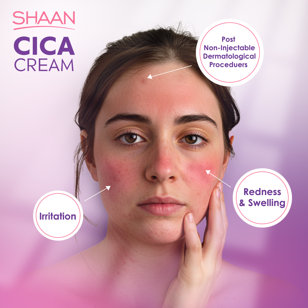 Shaan CICA cream 60 ml - Image 3 | Deoora