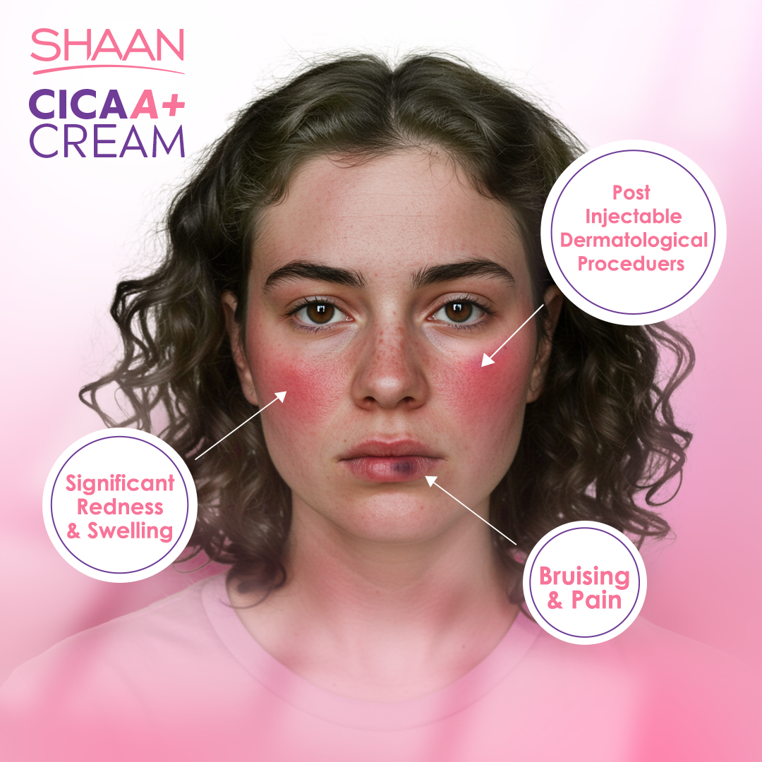 Shaan CICA ARNICA+ cream 40gm - Image 3 | Deoora