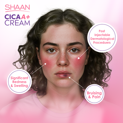 Shaan CICA ARNICA+ cream 40gm - Image 3 | Deoora