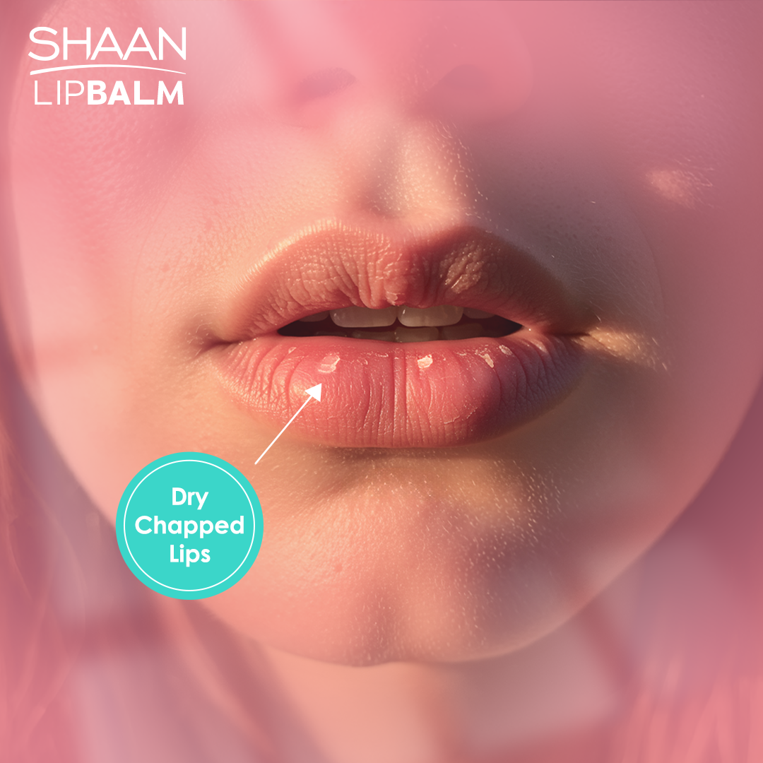 Shaan Lip Balm SPF 30 5 gm - Image 3 | Deoora
