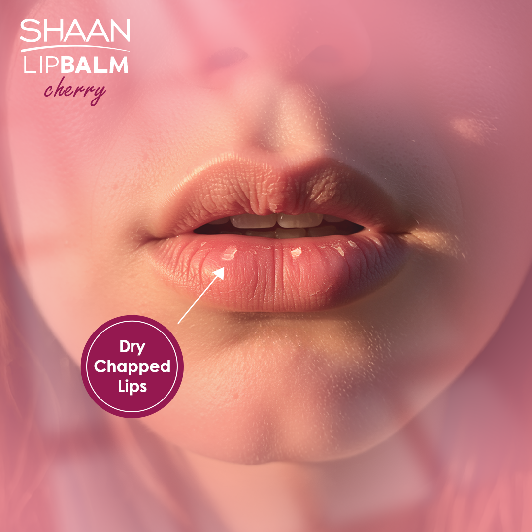 Shaan Lip Balm Cherry 5 gm - Image 3 | Deoora