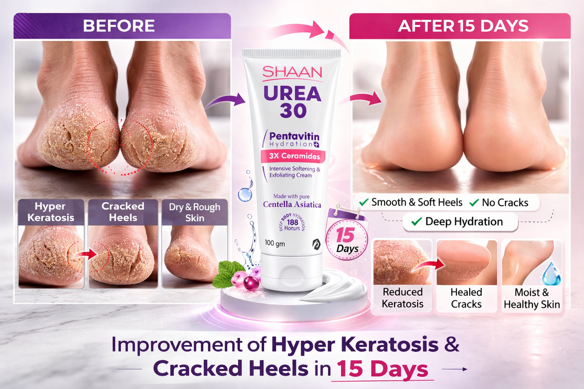 SHAAN Urea 30% Cream Exfoliating For Heavy Flakes & Cracked Foot - Image 2 | Deoora